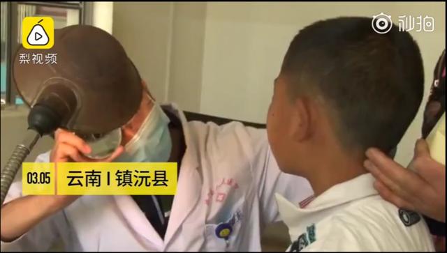 男童反复流鼻血竟是一条大蚂蝗,5岁男孩取出蚂蟥