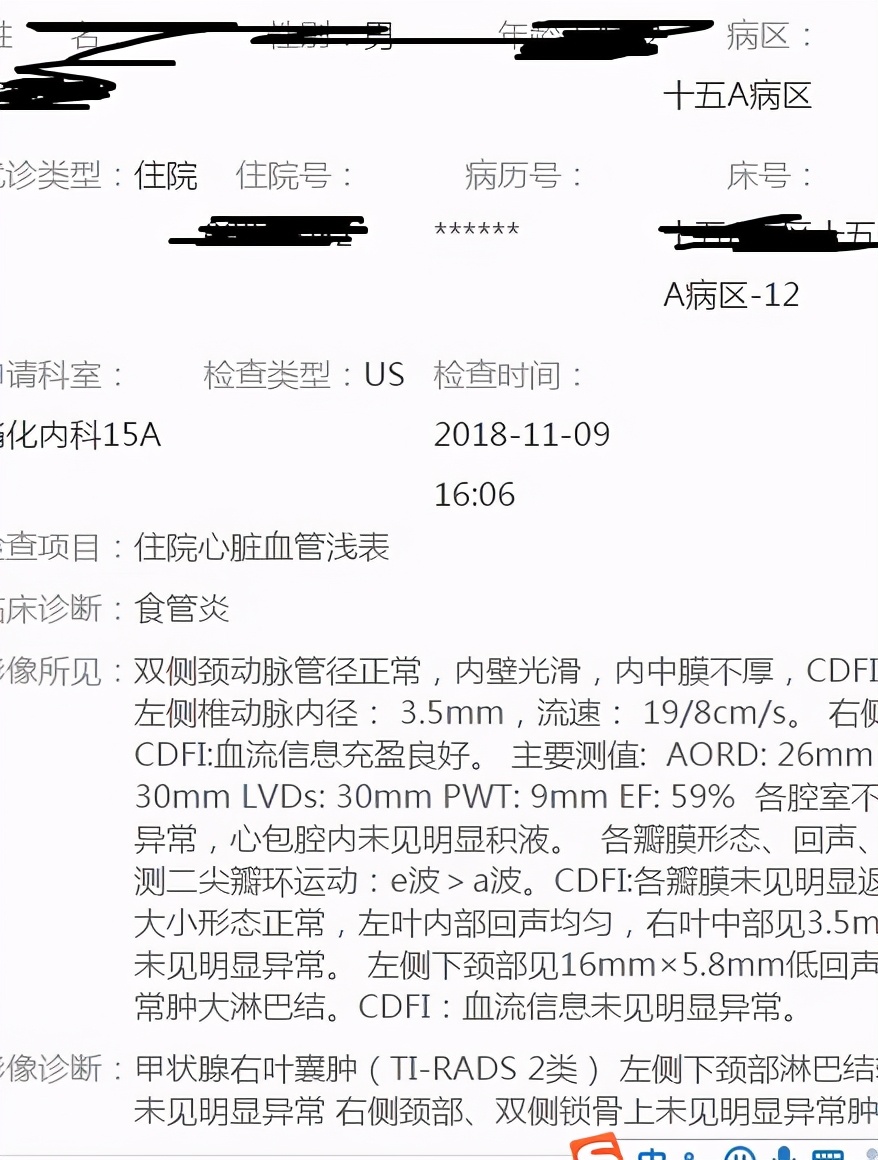 鱼刺卡喉祖传秘方求救,鱼刺卡喉轻松解决快1年了
