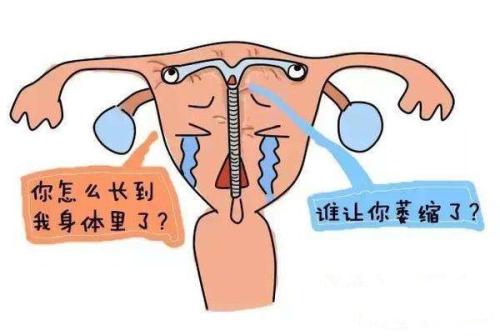 生完孩子到底要不要上环？上环的这几个副作用宝妈要知道