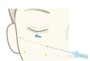 什么是线雕图片,什么是线雕线雕效果怎么样