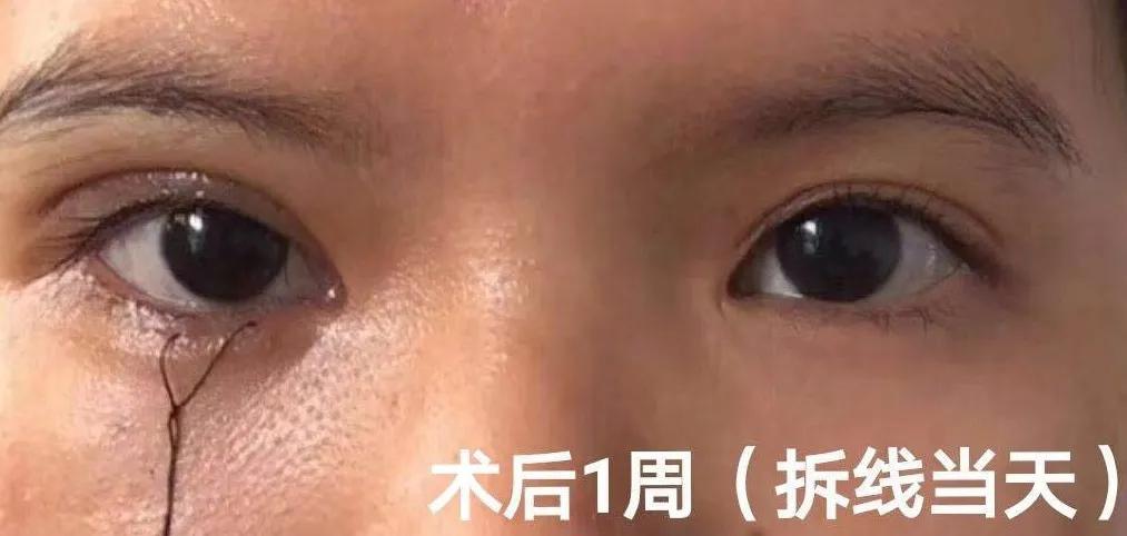 @儋州，赞！赞！赞！海南西部中心医院整复外科两例手术获好评