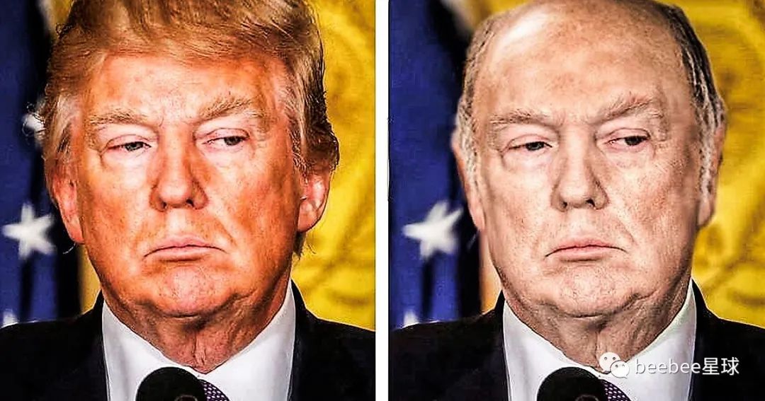 为什么老特的眼袋是白色的？