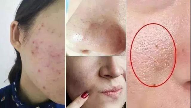 清洁毛孔的洁面皂,保持洗完脸的面部透亮