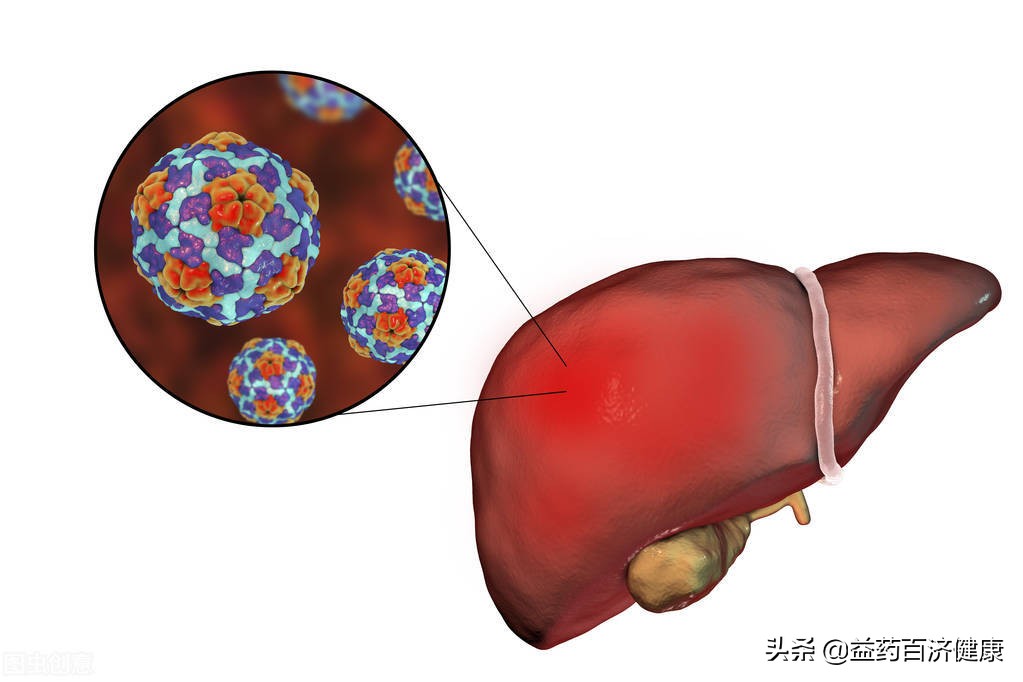 服用恩替卡韦抗病毒有哪些副作用,恩替卡韦抗病毒出现反复怎么办