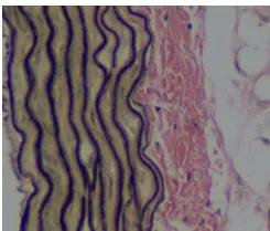 evg纤维染色阳性,evg染色图片处理