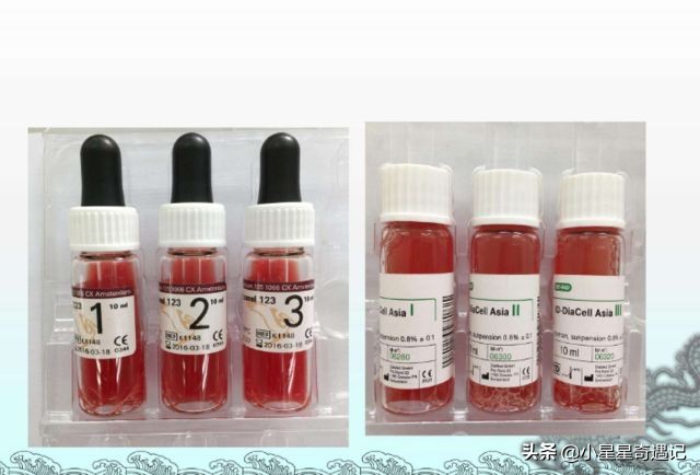 人类死之后身体会发生哪些变化,人类死亡后血液去哪了