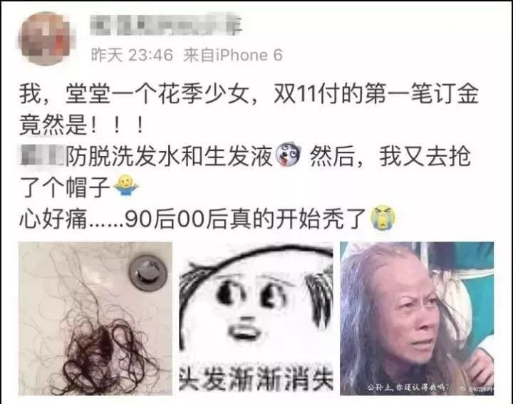 女生为啥发际线秃了,30岁发际线变秃