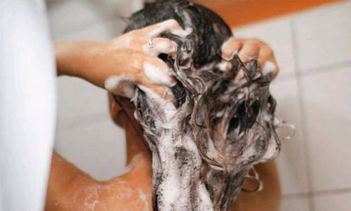 头皮屑太多的简单处理办法,头皮屑多怎么办最有效的方法