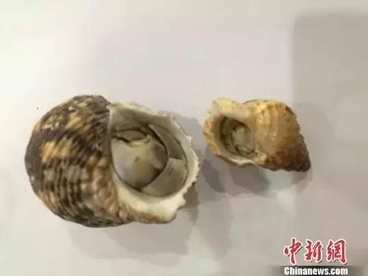 夏季警惕舌尖上的寄生虫,吃了不干净的东西哪里会有寄生虫