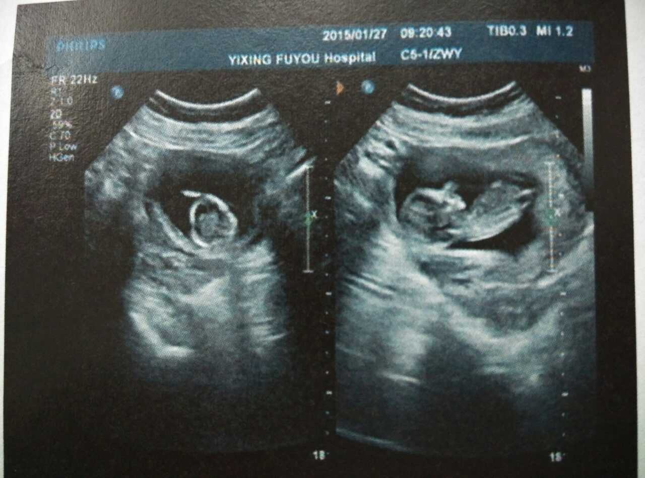 怀胎十月胎儿位置图,怀胎十月婴儿发育全过程