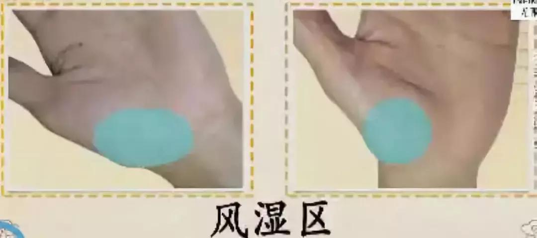 手健康有多重要,手型看健康