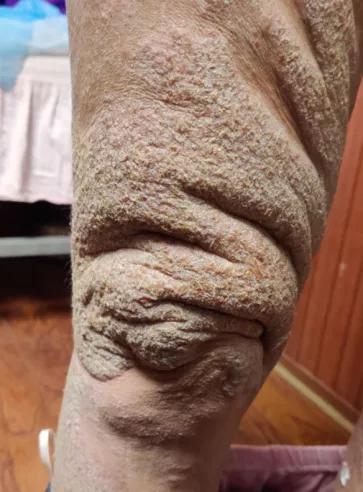 璋﹀窛涓尰,鏉窞璋﹀窛涓尰