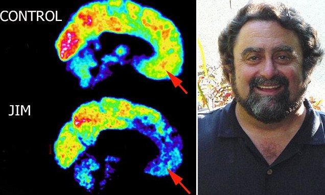 什么是心理变态,正常心理与变态心理的区别