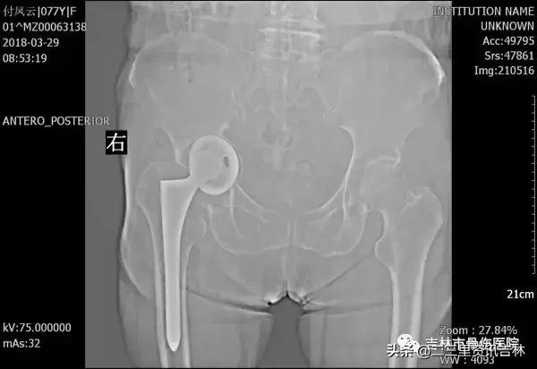 从医30余年，他治疗数以万计骨伤骨病患者