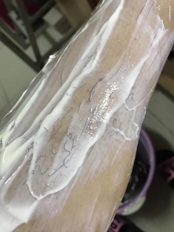 有体毛的女生要脱毛吗,体毛少可以不刮毛直接冰点脱毛吗