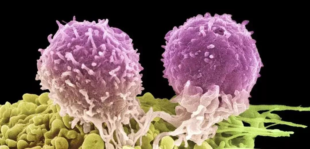 科学家找到癌细胞的生死开关,科学家找到了癌症的开关