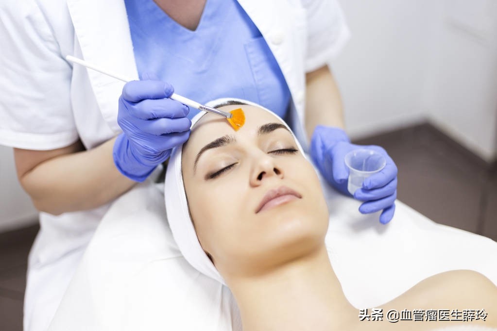 面部血管瘤激光后多久恢复正常,面部海绵状血管瘤3个办法消退