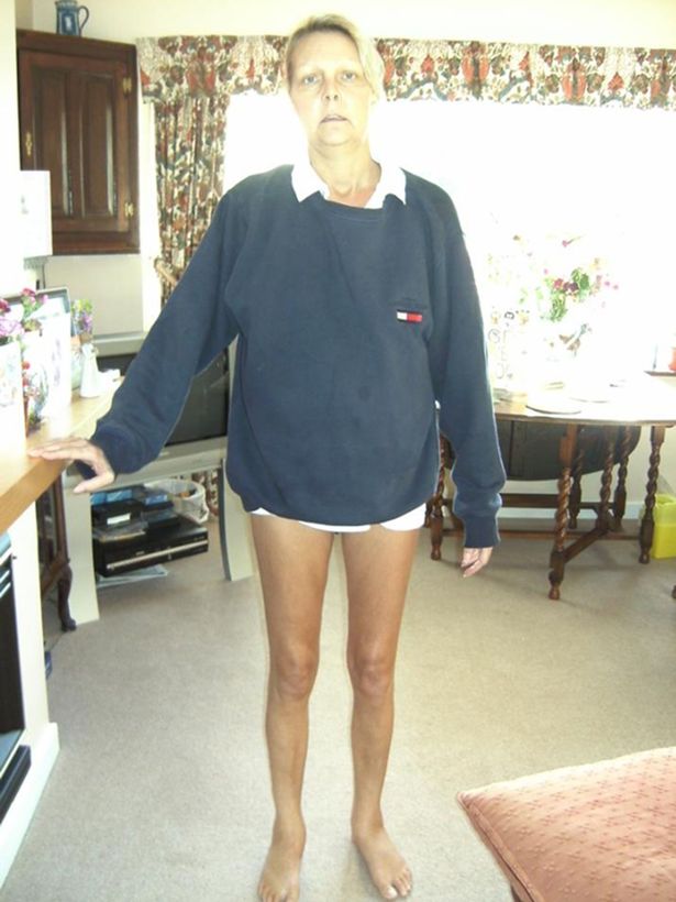 查出心脏萎缩能活多久,查出心脏萎缩