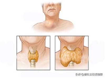 怕热心慌是什么情况,怕热出汗心慌怎么回事