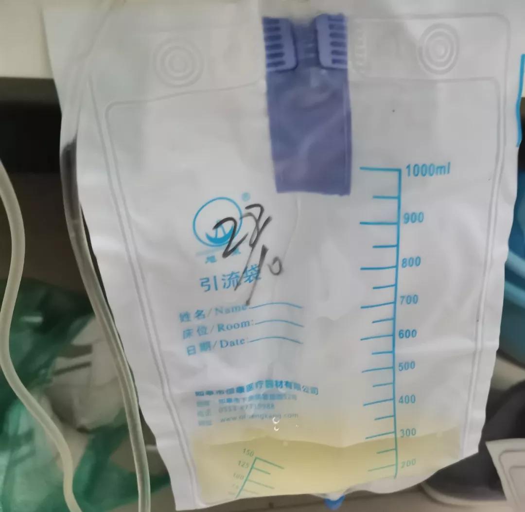 双肾造瘘术帮患者开通“尿道”——河北工程大学附属医院肿瘤一科联合超声科为患者解难题