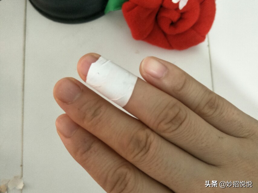 不小心划破了怎么避免留疤,被划伤用什么药愈合得快一点