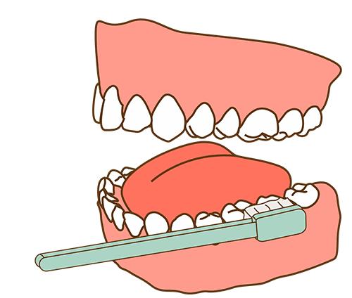 牙髓炎了不能继续再补牙吗,牙髓炎为什么不能自愈