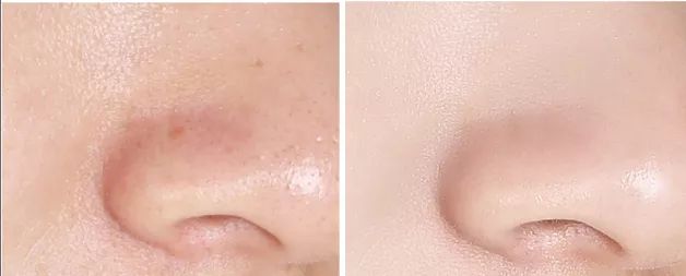 用了好多护肤品脸还是粗糙,化妆棉为什么越来越薄