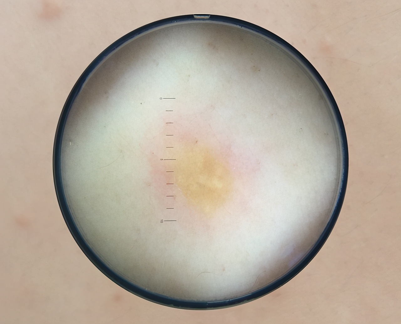 检查甘油三酯前喝了饮料,每天1瓶330毫升可乐有问题吗