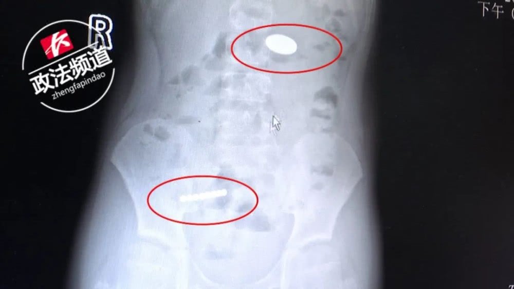 磁力珠玩具,警惕磁力珠玩具危险