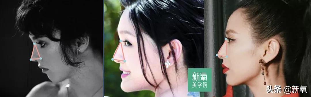 短翘鼻漂亮女星,小翘鼻适合方形脸