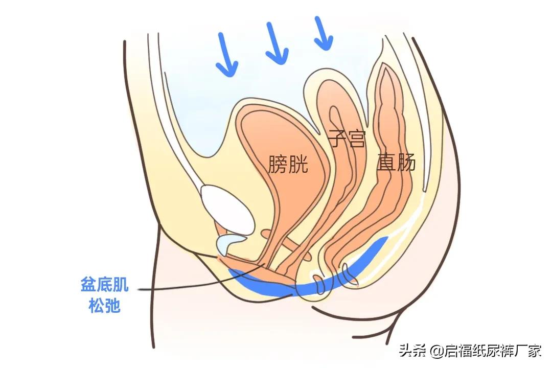 排便困难怎么锻炼,简单有效的懒人锻炼方法