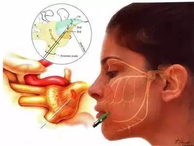 日照市岚山区人民医院视频,赣榆区人民医院疼痛门诊