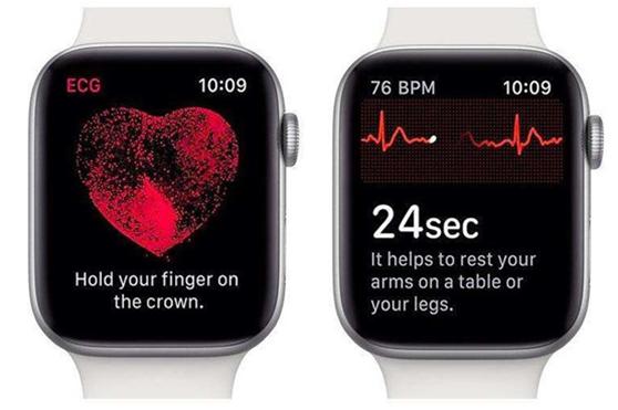 AppleWatch有几款性价比高的,applewatch好用的小组件