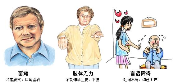 50岁男士预防脑梗吃什么药,63岁脑梗治疗后注意事项