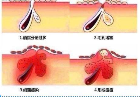 宝藏国货美容仪,比较好用的平价美容仪