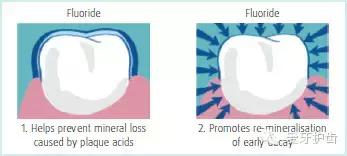 为啥含氟的牙膏便宜,牙医让使用含氟牙膏