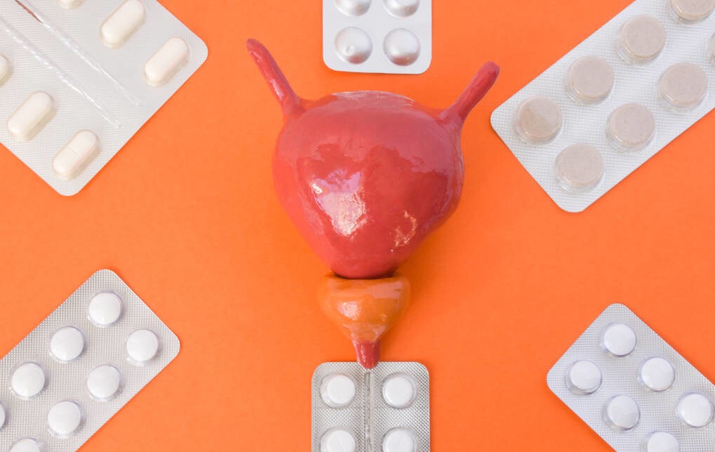 为什么会得前列腺钙化需要治疗吗,男性前列腺钙化是什么意思