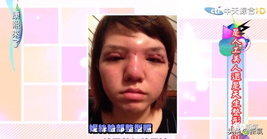 花90万从头整到脚，还可以这么自然？旁边纯天然小姐姐都看懵了