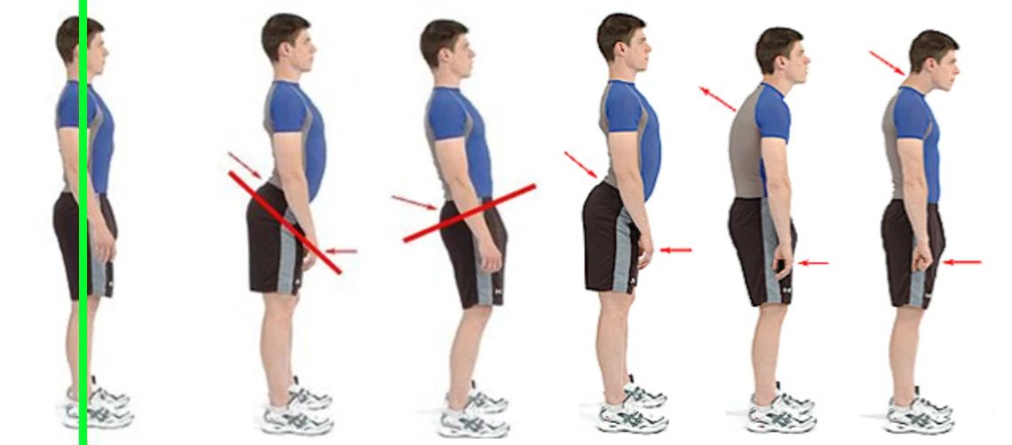 肋骨外翻治不了,练核心可以修正肋骨外翻吗