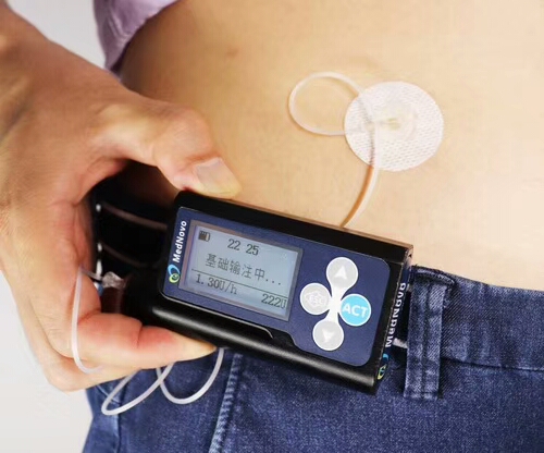 注射胰岛素局部过敏,甘精胰岛素过敏症状