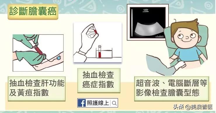 胆结石不治疗多久会转变为癌,胆结石不治疗会越来越严重吗