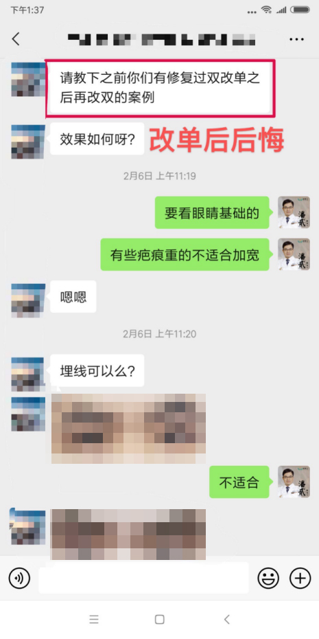 眼角下垂做双眼皮手术可以改变吗,后悔做双眼皮