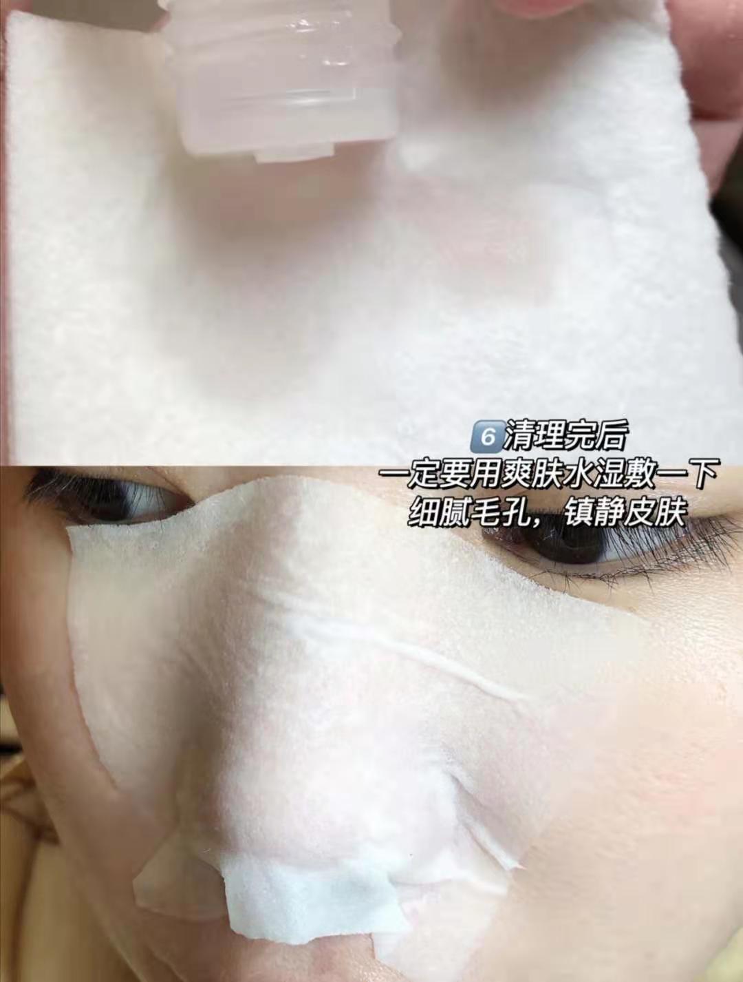 去黑头收缩毛孔的最好方法洗面奶,去黑头收缩毛孔的最好方法多少钱