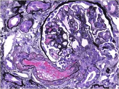 肾毒性食物一览表,肾毒性的药物排名