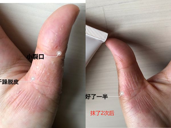 后脚跟干裂护足霜排行榜第一名,护脚霜脚后跟干裂修复霜国货