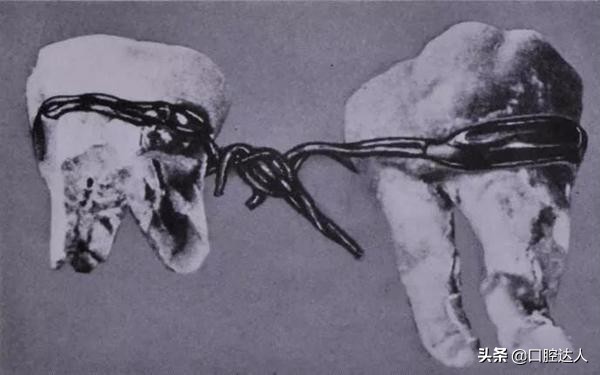 最全的牙科历史发展,牙医们大喊惊讶