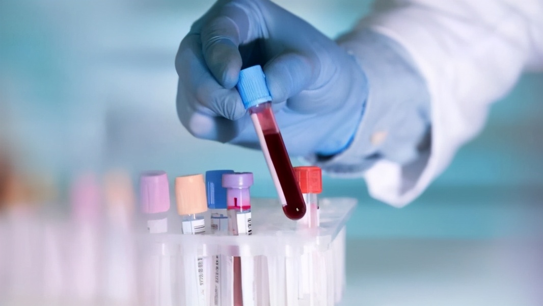 d-二聚体高如何降下来,d二聚体突然升高怎么回事