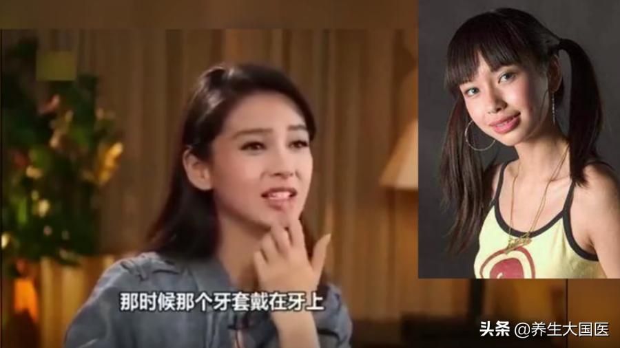 各种牙齿矫正的优缺点,牙齿矫正后对面部有改善吗