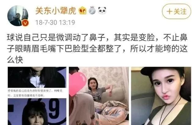 赵本山女儿自曝抑郁症,赵本山女儿自曝因父亲曾患抑郁症