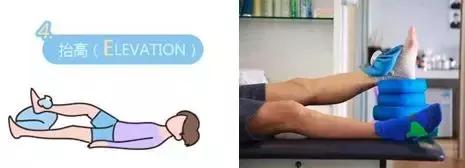 骨科医生治崴脚的日常,骨科林剑浩踝关节扭伤康复动作